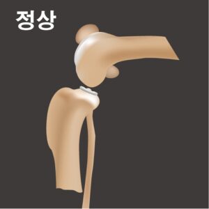 강아지 보조기 네발로