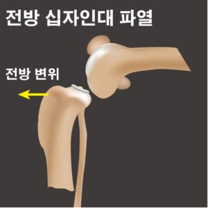 강아지 전방 십자인대